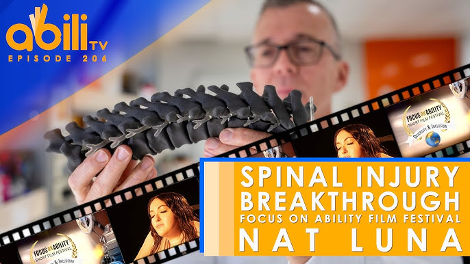 Spinal Injury Stem Cell Trial Begins plus R & B Artist Nat Luna gets ‘Off My Chest’